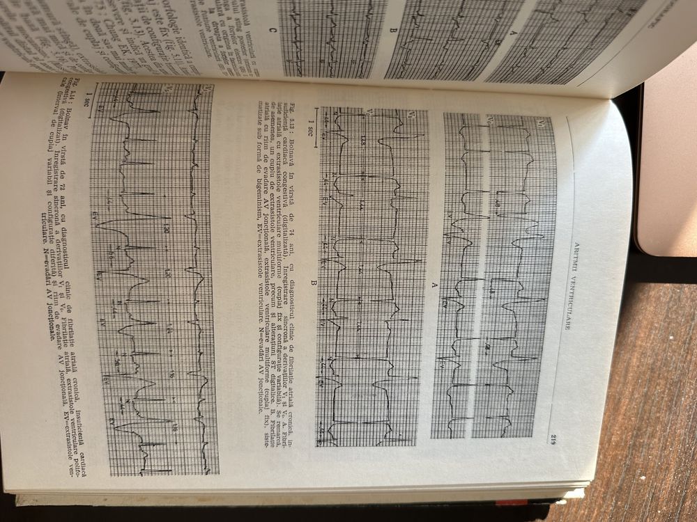 Diagnostic electrocardiografic - Carol Marcu