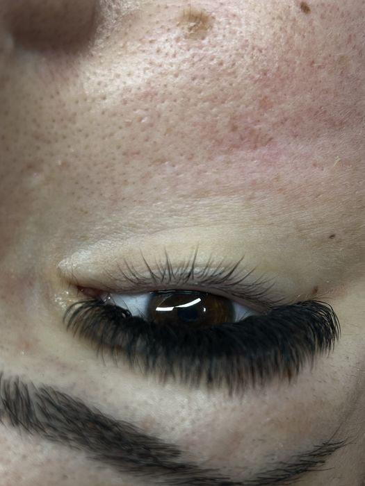 Aplic extensii de gene