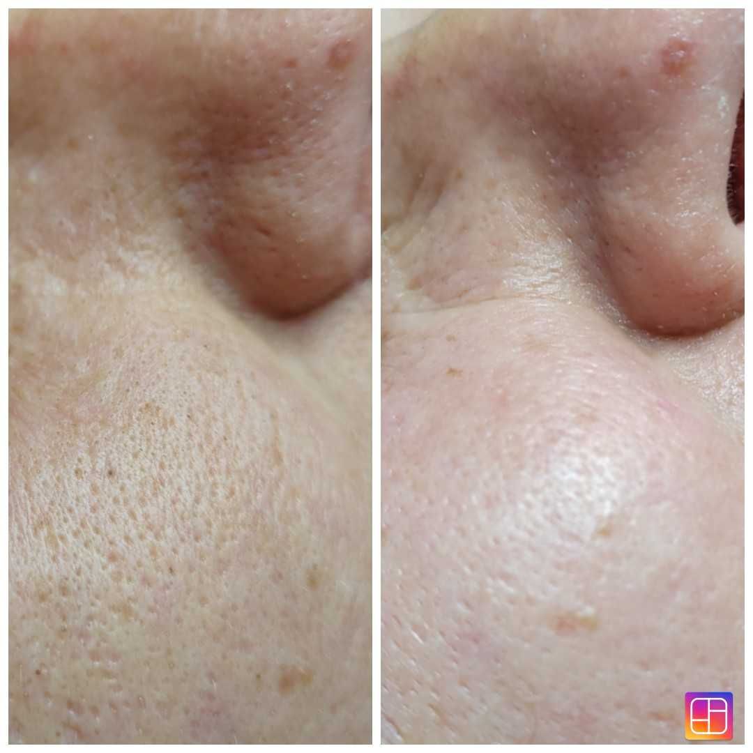 Cosmetica  / Pensat