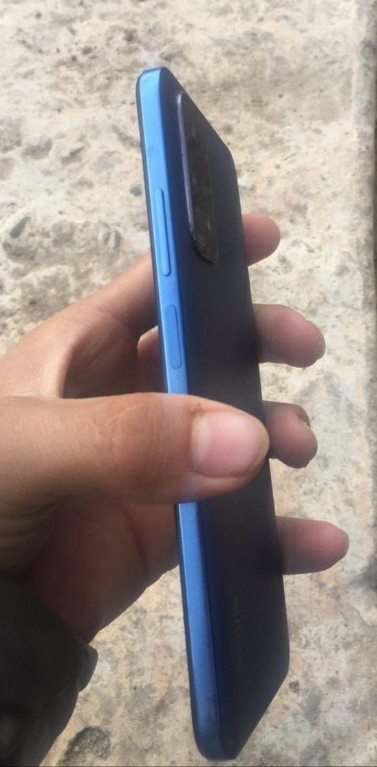 Redmi note 11 ideal
