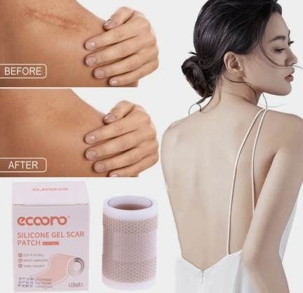 Силиконовый пластырь для лечения шрамов и рубцов. 4 см на 50 см