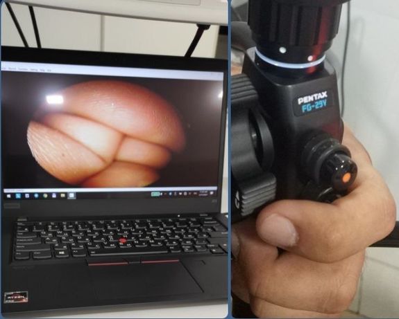 Портативная видео система для фиброскопов PENTAX
