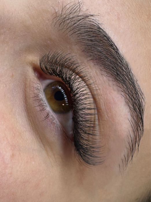 Extensii de gene - Timisoara