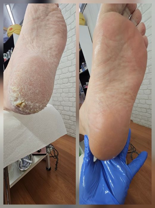 Pedichiură clasică Oradea