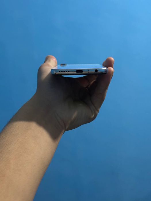 Redme note 8 holati yaxshi