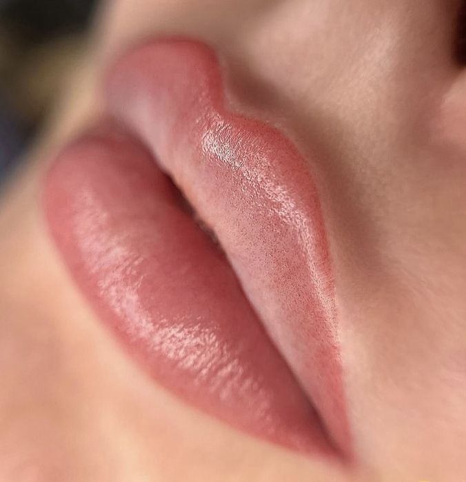 Remodelare nas și buze