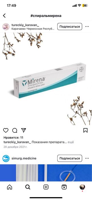 Спираль внутриматочная
