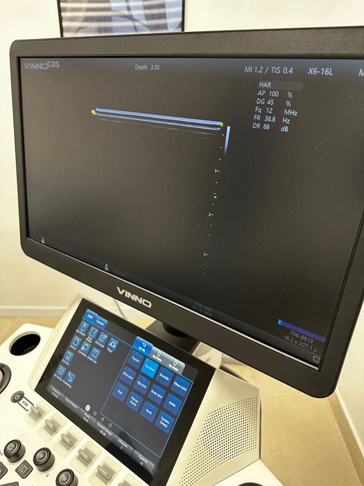 Vând sau închiriez ecograf ViNNO E35 – aproape nou,garanție valabilă