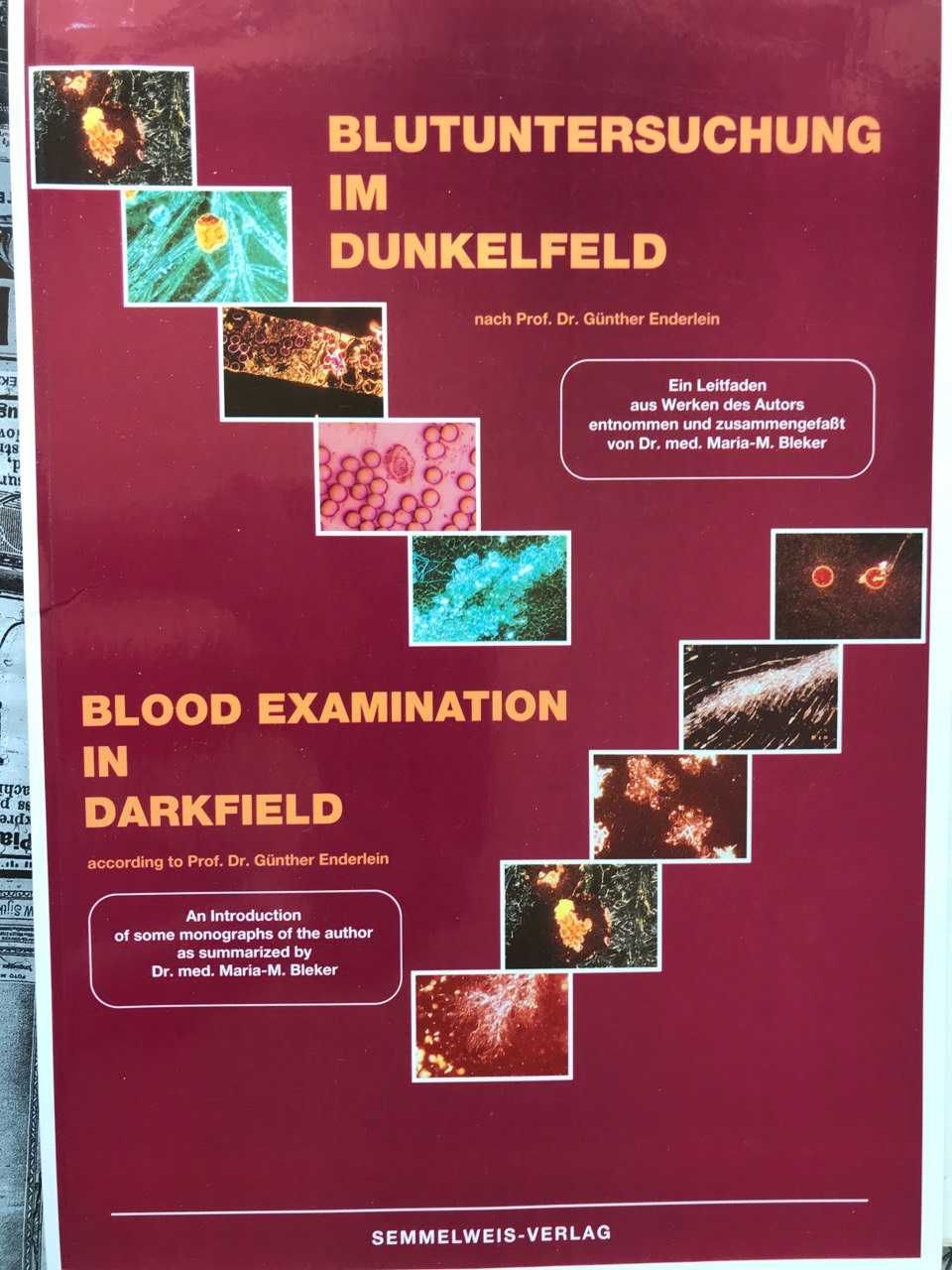 Микроскоп за изследования във томно поле/ Dark Field Microscope