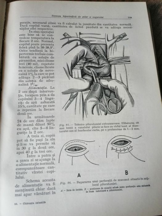 Chirurgie infantila de urgenta