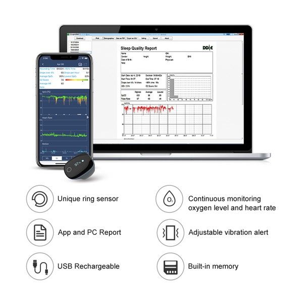 Viatom / Wellue O2 Ring™ - Кислороден монитор с пръстен