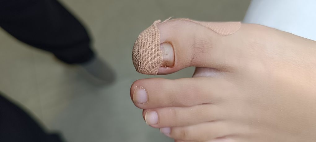 Подология здоровье ногти и стопы