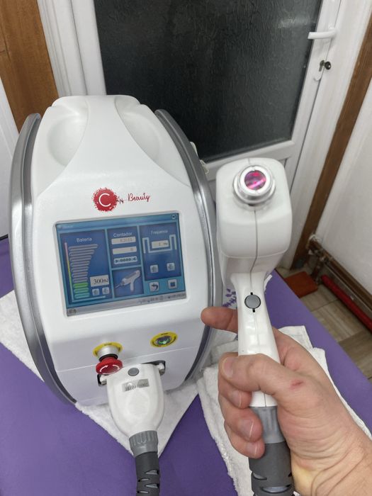 Laser stergere tatuaje