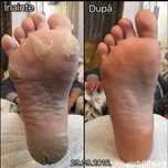 Pedichiură pentru toți : Femei și Bărbați
