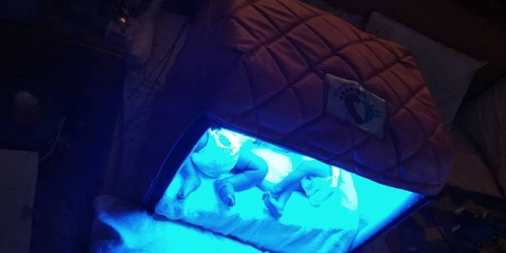 Фотолампа, быстрое восстановление под контролем специалистов