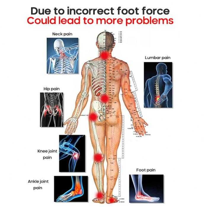 Ортопедични Стелки О-образна Форма на Краката OX Крак Дюстабан Стъпало