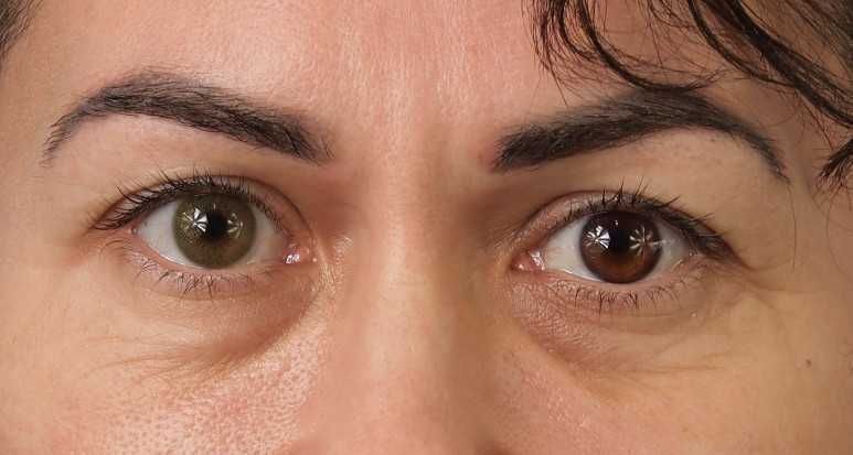 Maldives - lentile de contact colorate anuale, pachet complet