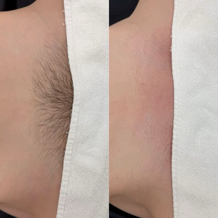 Depilyatsa hizmati uyingizda