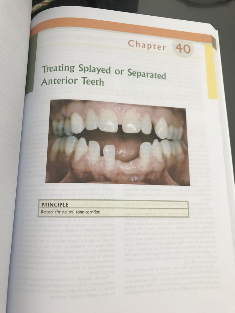 Functional Occlusion from TMJ to Smile Design-Peter E. Dawson