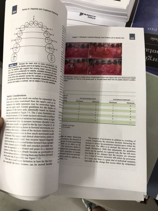Contemporary Orthodontics,William R. Proffit,6th edition 2019