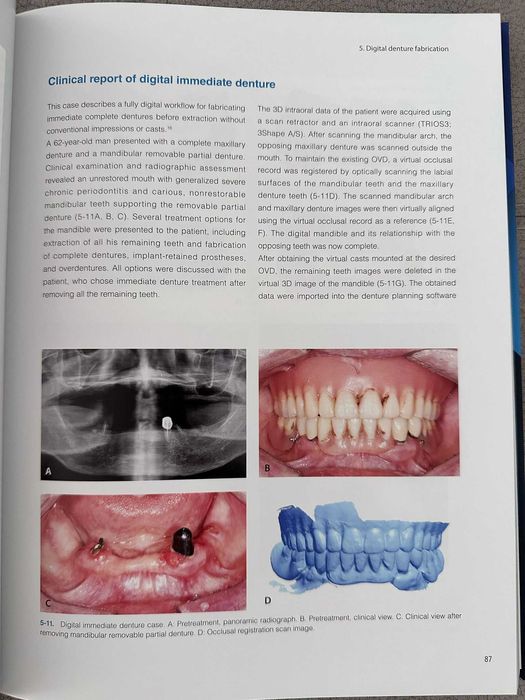 Carte stomatologie Digital Full Arch