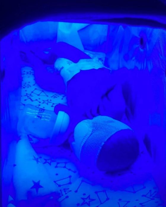 Fotolampa Fototerapiya Фотолампа Фототерапия 100 000 сум