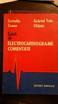 Caiet de electrocardiograme comentate