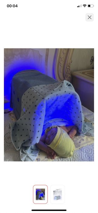 Лампа против желтушки