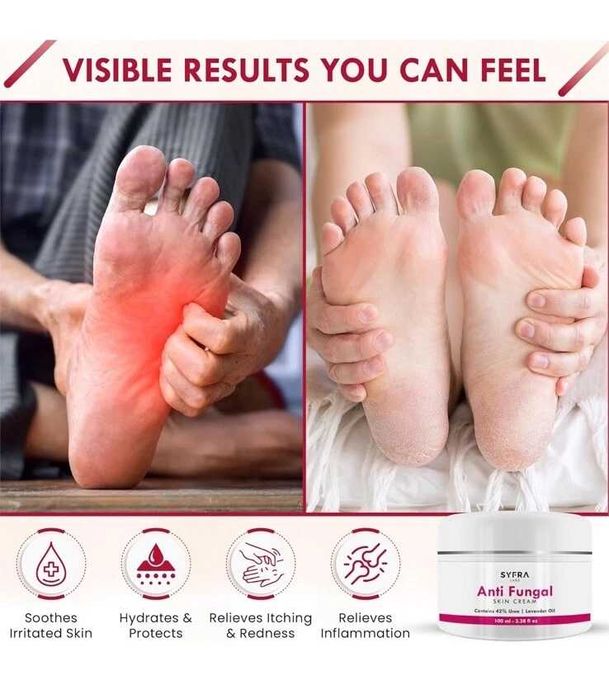 Нов Крем против гъбички с урея и лавандула за крака и нокти Лечение