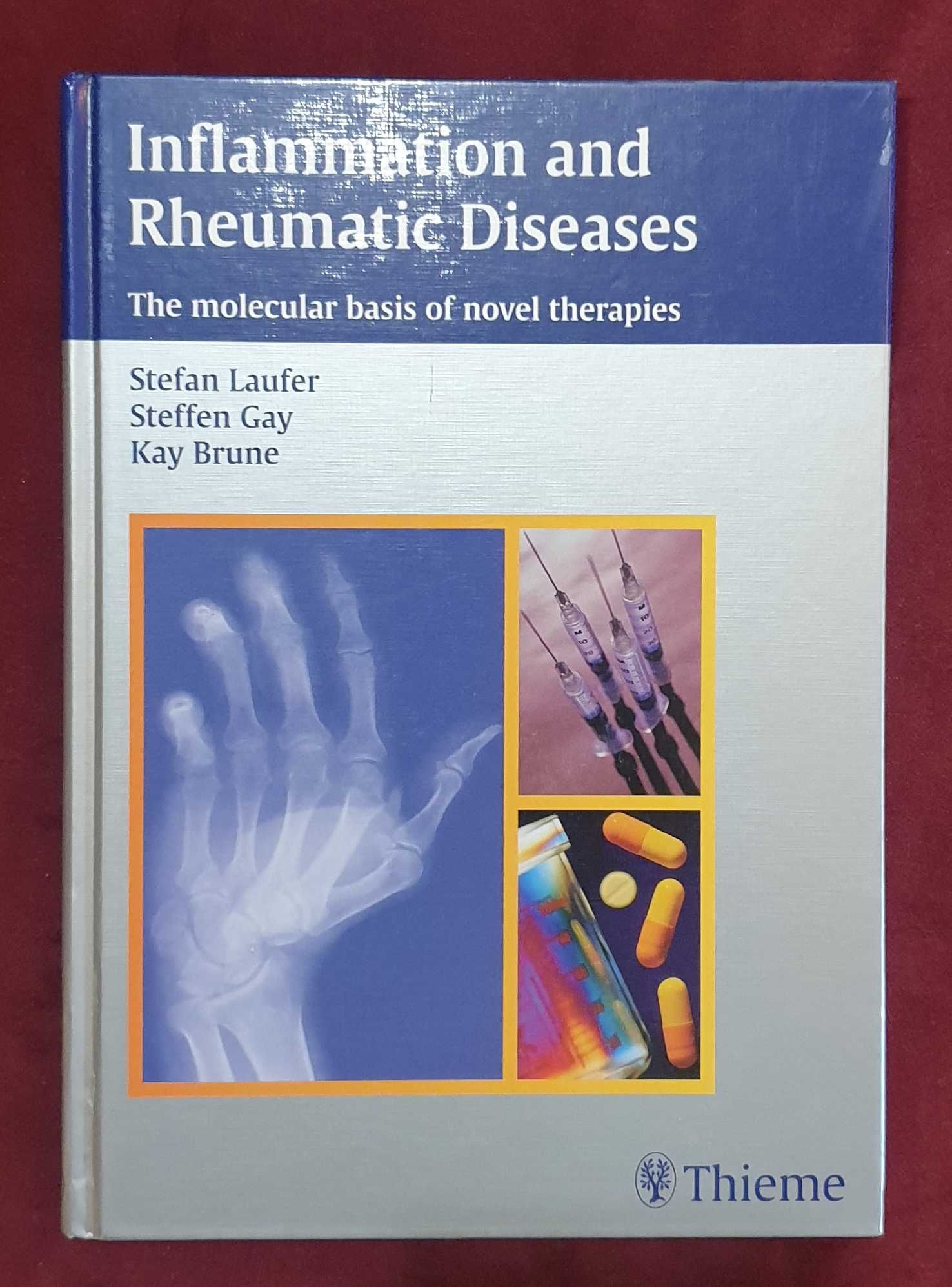 Inflammation and Rheumatic Diseases.Molecular Basis of Novel Therapies