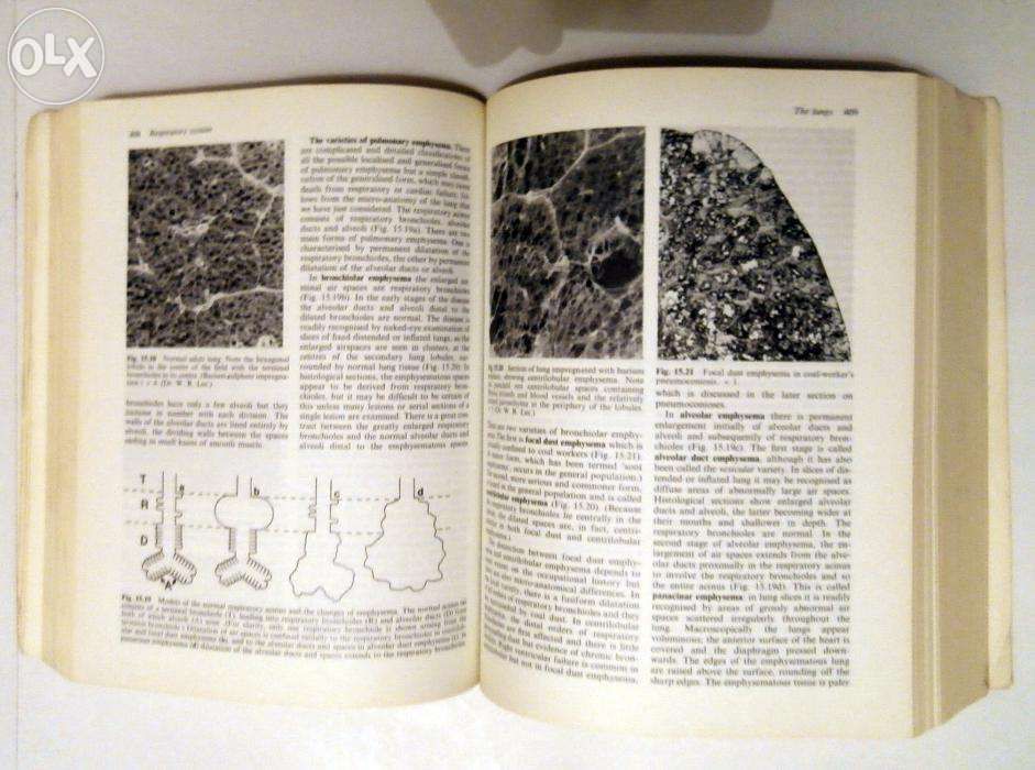 Muir's Textbook of Pathology, 10th Ed. (Anderson)