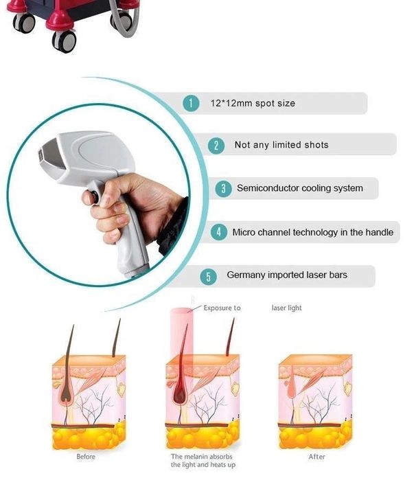 De Vanzare. 808NM Diode Laser
