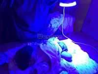Аренда фотолампы от желтушки новорождённых