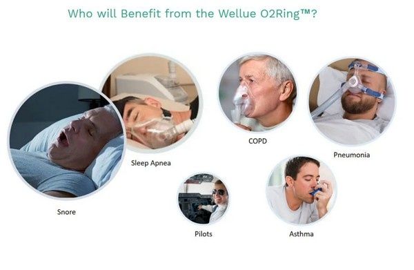 Viatom / Wellue O2 Ring™ - Кислороден монитор с пръстен