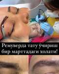Удаление растушовка тату