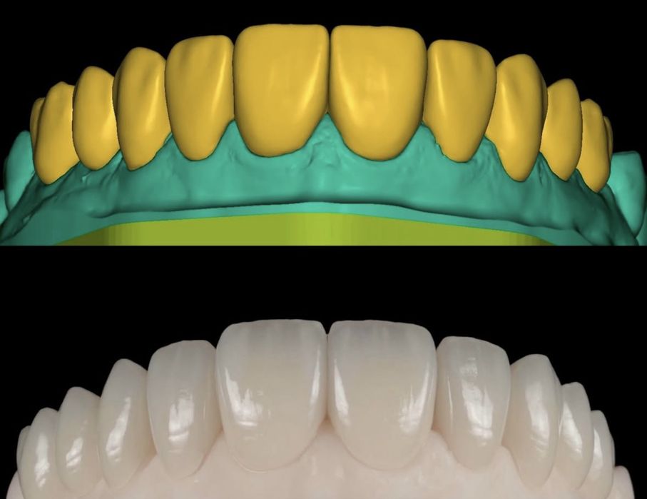 Colaborare Tehnician Dentar