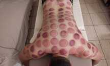 Masaj Terapeutic -Reflexoterapie Ventuze Relaxare