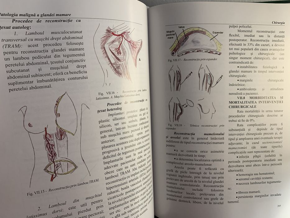 Tratat oncologie Patologia maligna a glandei mamare Prof Bădulescu