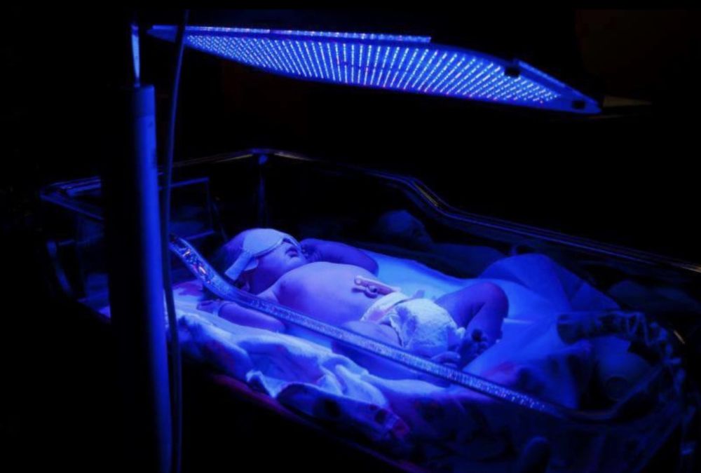 Fotolampa ot bilirubina,ot jeltushki.Fototerapija.Фото лампа от желтуш