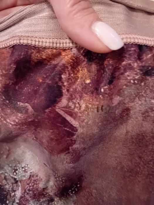 Клиника на Oysho