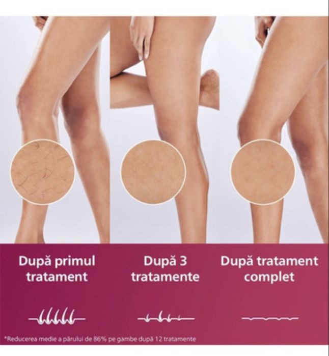 Epilator IPL Philips Lumea Seria 9900