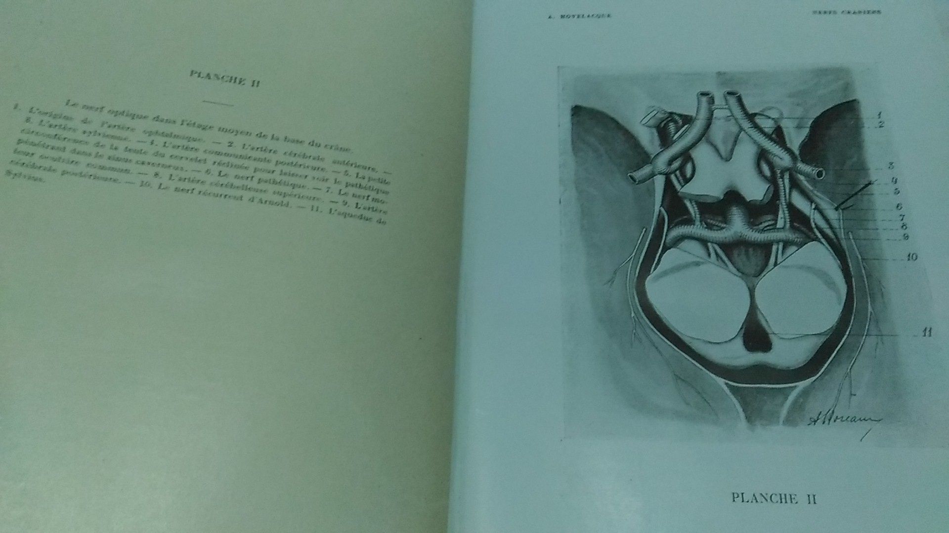 Anatomie des Nerfs Craniens et Rachidiens-A. Hovelaque 1927