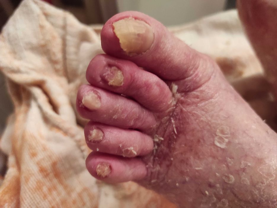 Медицински педикюр по домовете