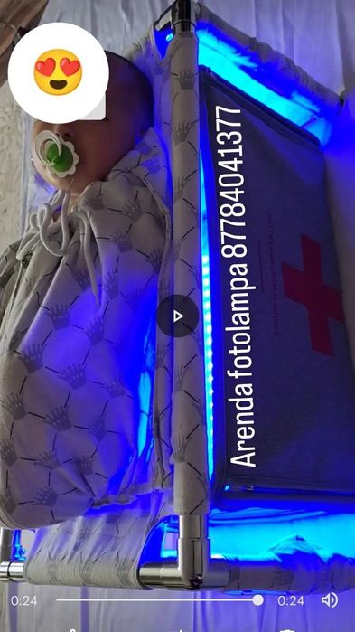 Фотолампа от желтушки продаж