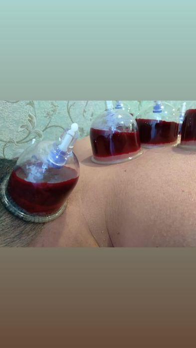 Делаю хиджаму ..