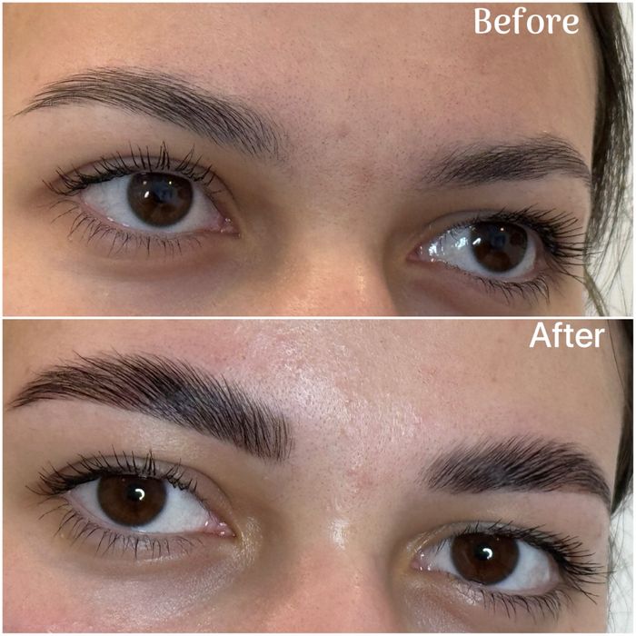 Laminare gene si sprancene