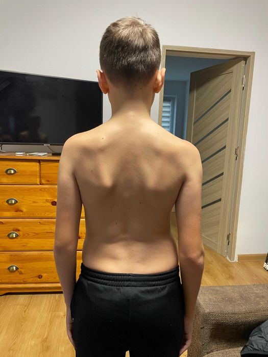 Kinetoterapie la Domiciliu