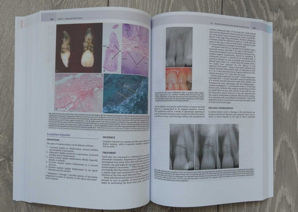 Cohen's Pathways of the Pulp: 12th Edition Engleza