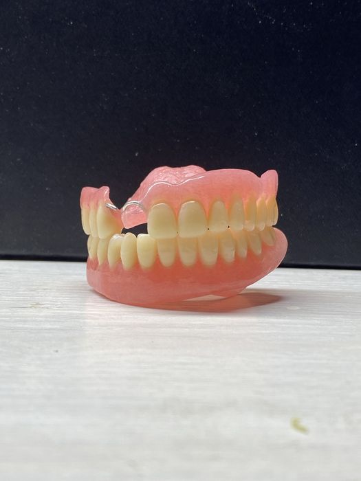 Изготовление протезов любой сложности Kaspi red/каспи рассрочка