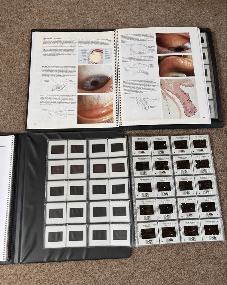 Atlas de oftalmologie/ Slide atlas of ophtalmology